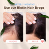 Morfose Biotin Hair Drops 100ml - Effective Hair Loss Treatment and Strengthening Serum