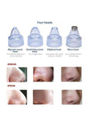 Globalstar Blackheads Vacuum Removal - XN8030 - Awarid UAE