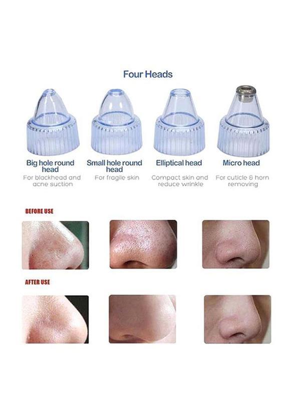 Globalstar Blackheads Vacuum Removal - XN8030 - Awarid UAE